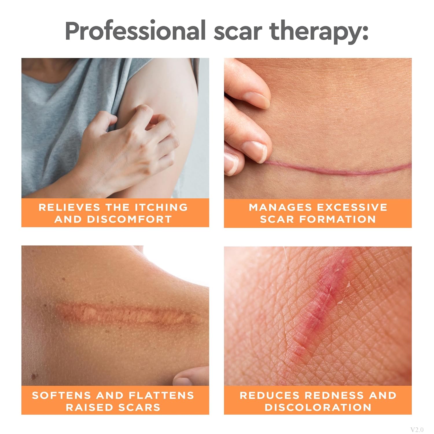 Strataderm Scar Therapy Silicon Gel 50g